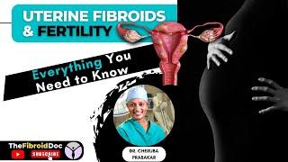 Uterine Fibroids & Fertility - Everything You Need to Know || TheFibroidDoc.