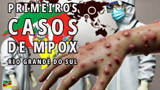 PRIMEIROS CASOS DE MPOX NO RIO GRANDE DO SUL