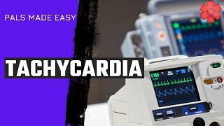 Pediatric Advanced Life Support (PALS) Tachycardia Algorithm