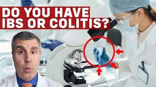 Colitis And IBS