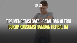 Tips Mengatasi Gatal-gatal dan Alergi Ala dr. Zaidul Akbar