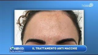 Macchie viso: ecco come eliminarle