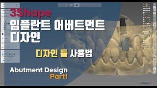 3Shape 어버트먼트 디자인 툴 사용법 알아볼까요.?