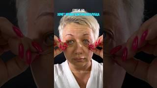 Вернули молодой овал без подтяжки лица Подтяжка шеи. Круговая блефаропластика. Док НИКОЛАЕВА С.А.