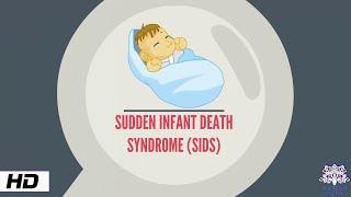 Sudden Infant Death syndrome, Causes and Prevention