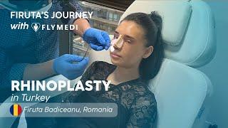 Rhinoplasty in Turkey   Firuta's Journey,  Age 24 | FLYMEDI