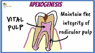 PEDIATRIC DENTISTRY | APEXOGENESIS