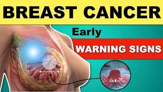 Breast Cancer Symptoms | Early Warning Signs of Breast Cancer | Breast Examination