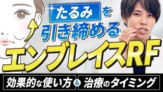 【エンブレイスRF】その使い方は金ドブ！エンブレイスRFの“効果的な使い方”＆”治療の限界”を解説【たるみ治療】