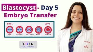 Blastocyst day 5 Embryo transfer