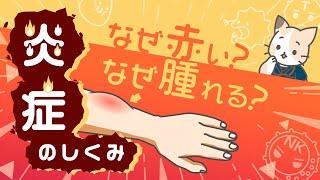 蚊に刺されるとなぜ腫れる？炎症のしくみ　～炎症の4徴候、慢性炎症、抗炎症薬～