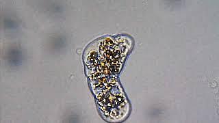 Amoebe (filmed with Bresser LCD Microscoop 3.5 Inch)