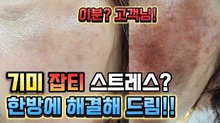 기미 관리의 시작 안 보이게 하면 됩니다