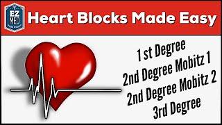 AV Heart Blocks Made Easy | 1st, 2nd, 3rd Degree [ECG Interpretation Explained]