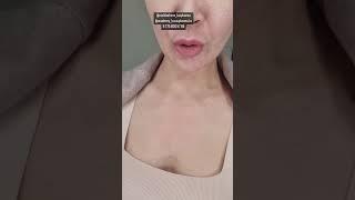 День 9. Плазменное омоложение кожи для себя. Зона нижней части лица, шеи и декольте.