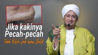 Kaki Pecah-pecah Tidak Boleh Jadi Imam Shalat - Habib Hasan Bin Ismail Al Muhdor