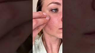 Glov Beauty Micro-Infusion System: Real Customer Review & Transformation #microinfusion #glovbeauty