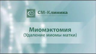 Миомэктомия