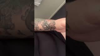 Using skin color pigmentation ink over black tattoo