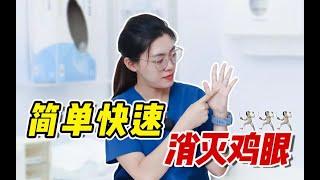 【健康】鸡眼能根治吗？正确去除鸡眼的方法悄悄告诉你！