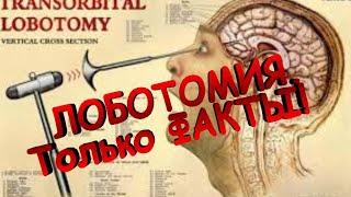 Что такое Лоботомия? Факты о Лоботомии.