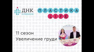 Итоги операции по увеличению груди с имплантами 11 сезона проекта "Пластика Life"