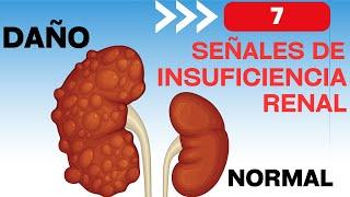 7 signs that you will have chronic kidney disease