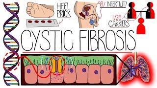 Understanding Cystic Fibrosis (Includes Pathophysiology & Diagnosis)