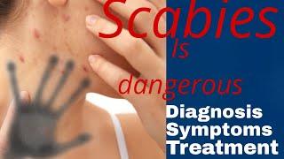 Scabies: The Disease You Didn't Know Existed