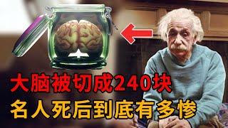 被切成240塊後，科學家在愛因斯坦大腦發現了什麼？