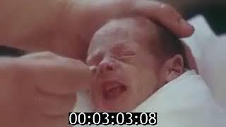 Недоношенный ребенок  (Документальный фильм)