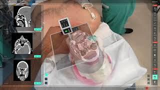 See the unseen - Medivis SurgicalAR Technology Using Augmented Reality