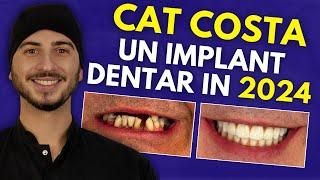 Cat costa un implant dentar? Afla pretul unui implant dentar in 2024