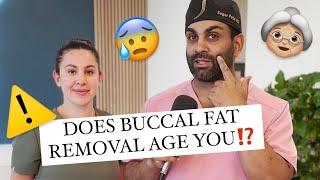 Will Buccal Fat Removal Make You Look Old!?