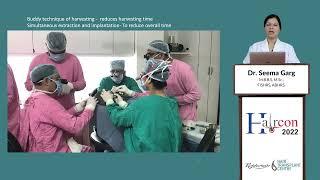 Mega Session Hair Transplant | Dr. Seema Garg, Indore