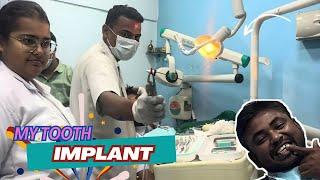 Implant in my tooth | Complete Guide Getting a Tooth Implant Step-by-Step. My Implant Transformation