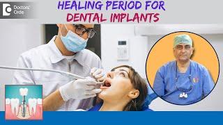 TOOTH IMPLANT HEALING TIME |Dental Implant|Keyhole implant-Dr.Manesh Chandra Sharma| Doctors' Circle