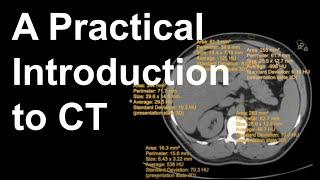 A Practical Introduction to CT