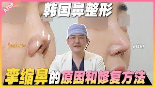 【韩国爱她】 鼻整形修复，李汉正院长的科普讲解：“炎症和挛缩的问题”