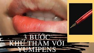 Hướng dẫn khử thâm 3 bước với YumiPens