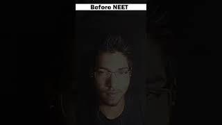 Before(Lallu) and After NEET(All India Topper)|Part 1#motivation #neet2022
