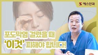 포도막염 걸렸을 때, '이것' 피해야 합니다!