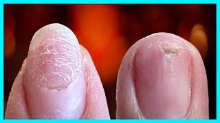 STOP DAMAGING Your Natural Nails! TRY My Proven Technique