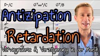 Antizipation & Retardation: Vorhalt & Vorwegnahme in der Musik - Die Synkope & ihre Auswirkungen