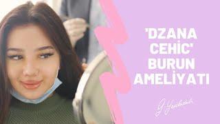 Dzana Cehic | Burun Estetiği | Op.Dr. Güray Yeşiladalı #burunestetiği #rhinoplasty