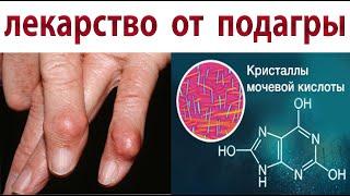 Как снизить уровень мочевой кислоты и вылечить подагру