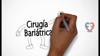 ¿Qué es la cirugía bariátrica?