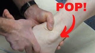 Peroneus longus subluxation: How to treat it!