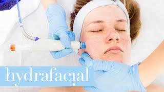 How does HydraFacial treatment work?