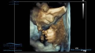 Scan of the Week: 34 Week 3D/4D Bonding Baby Scan